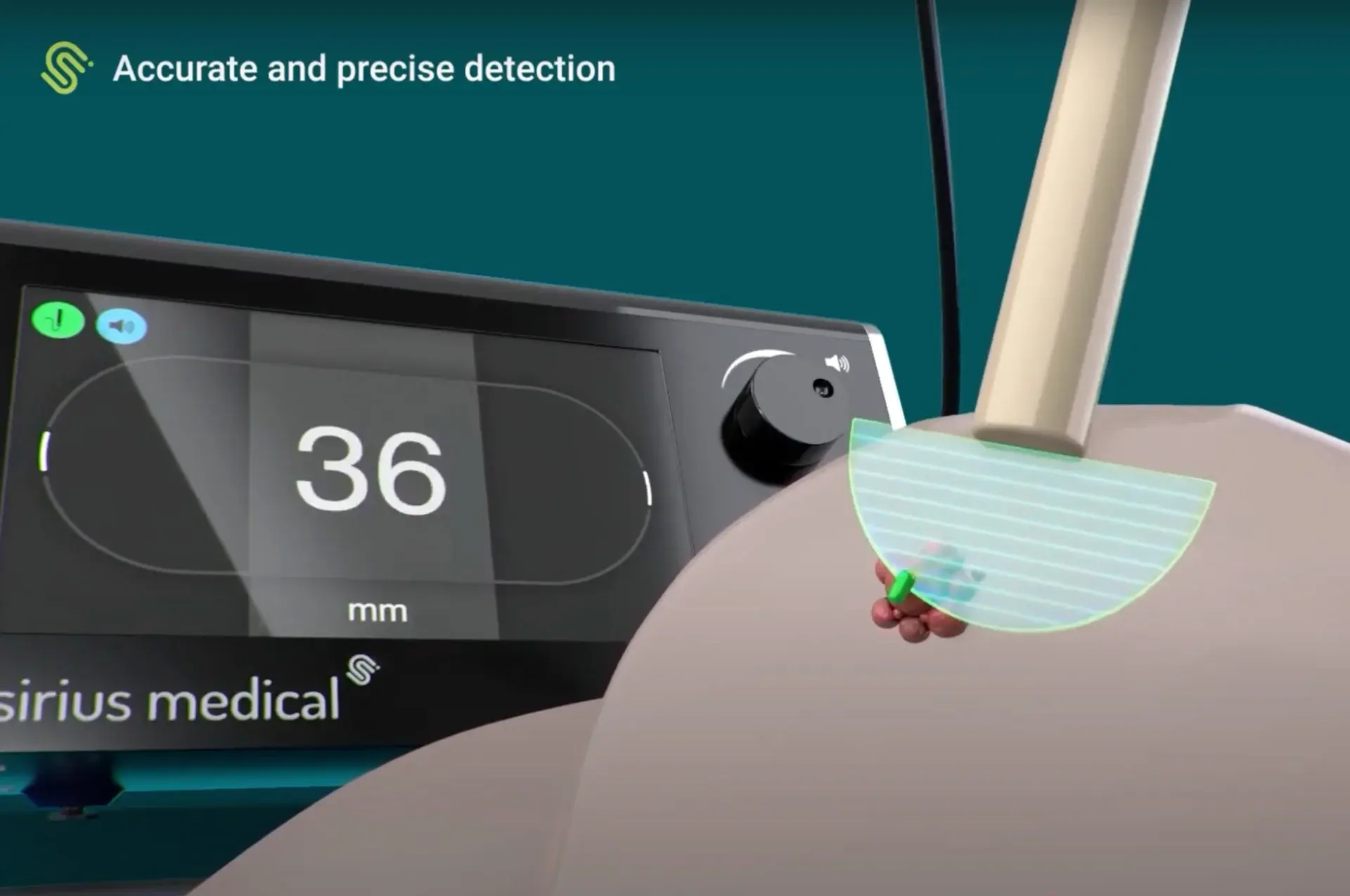 Discover how oncology medical devices improve surgical outcomes in breast cancer care. Learn how Sirius Medical contributes to clinical precision and workflow efficiency.